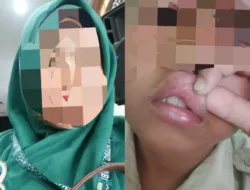 MIRIS : TW Oknum Guru Di Muaro Jambi Aniaya Anak Didiknya